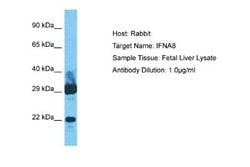 IFN-alpha B2/IFN-alpha 8 Rabbit anti-Human, Polyclonal, Novus Biologicals 0.1 mL | Buy Online | Novus Biologicals | Fisher Scientific
